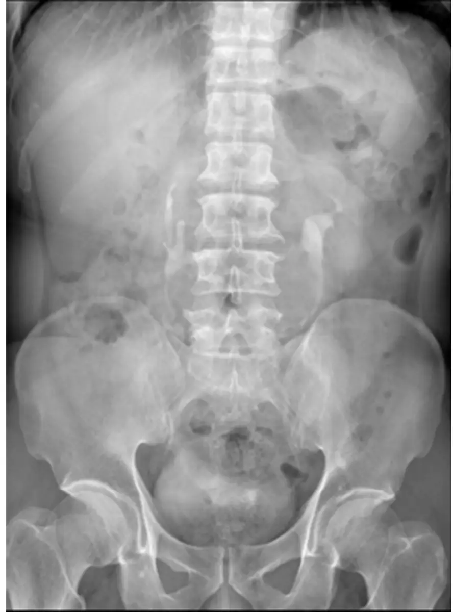 圖片